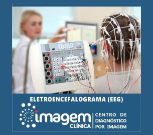 eletroencefalograma(1920 x 1080 px)