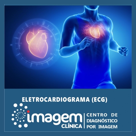 ELETROCARDIOGRAMA (1920 x 1080 px)
