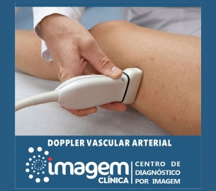 doppler vascular (1920 x 1080 px)