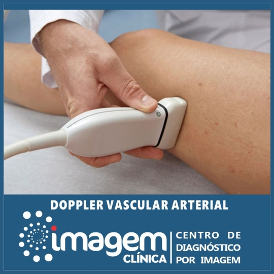 doppler vascular (1920 x 1080 px)