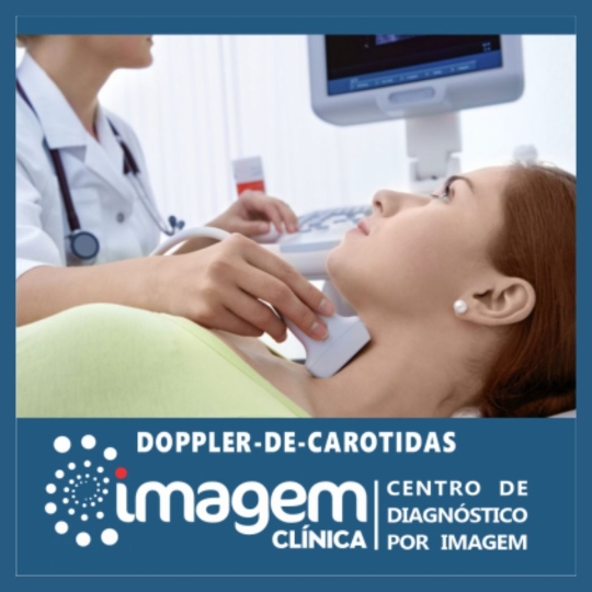 doppler carotida (1920 x 1080 px)