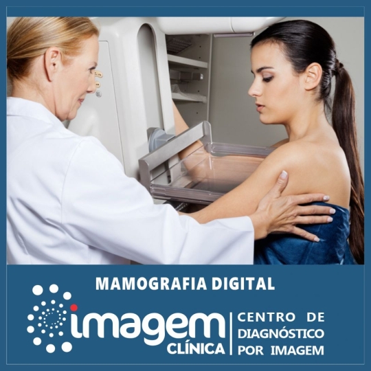 mamografia(1920 x 1080 px)